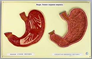 Модель барельефная "Желудок" (внешняя и внутренняя поверхности)