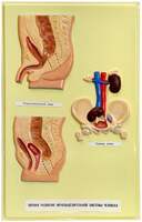 Пороки развития мочевыделительной системы  человека (1 планшет, 42х66 см)
