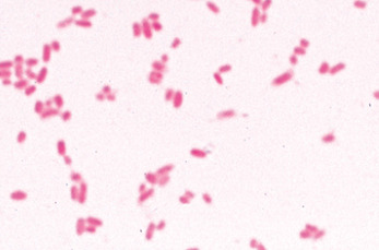 Бактерии (Bacteria), комплект  – 25 слайдов / 1003969 / W13040