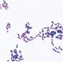 Бактерии (Bacteria), комплект  – 25 слайдов / 1003969 / W13040
