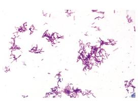 Бактерии (Bacteria), комплект  – 25 слайдов / 1003969 / W13040