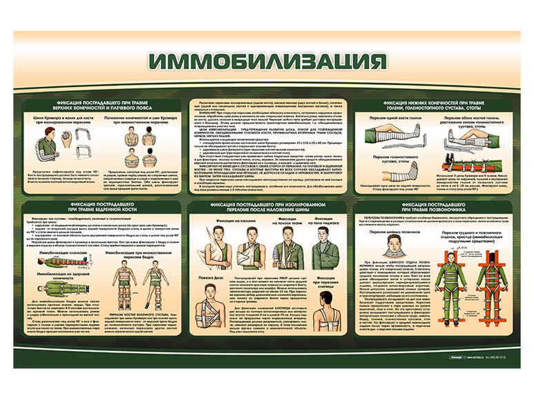 Стенд "Иммобилизация"