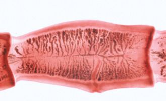 Серия V. Генетика, репродукция и эмбриология – слайды с надписями на английском языке / 1004229 / W1