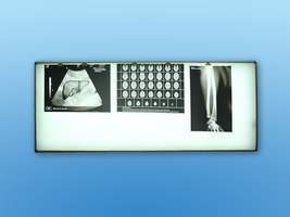 Стенд световой для рентгеновских снимков (Станция "Медицина")