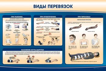 Стенд «Виды перевязок»