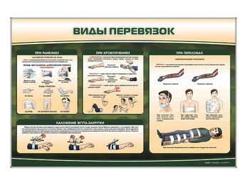 Стенд «Виды перевязок»