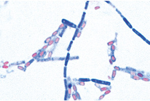 Патогенные бактерии – слайды с надписями на английском языке / 1004249 / W13424