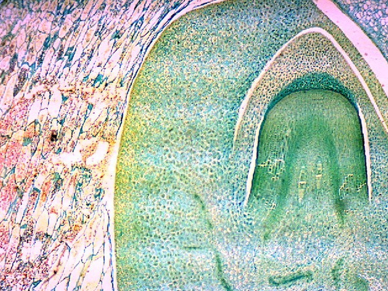 Микропрепараты ботаника. Микропрепарат завязь и семяпочка. Семяпочка под микроскопом. Завязь и семяпочка под микроскопом. Микропрепарат завязь.