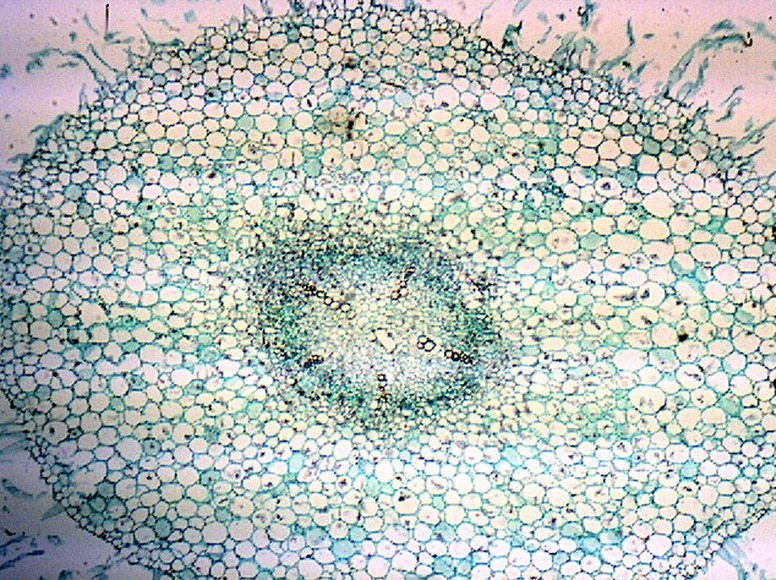 Какой микропрепарат изображен на рисунке. Микропрепарат травянистого стебля. Ткани растений микропрепараты. Ботаника под микроскопом. Микропрепараты анатомия растений.